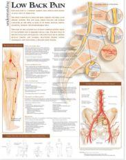 Understanding Low Back Pain Anatomical Chart - Chiro1Source