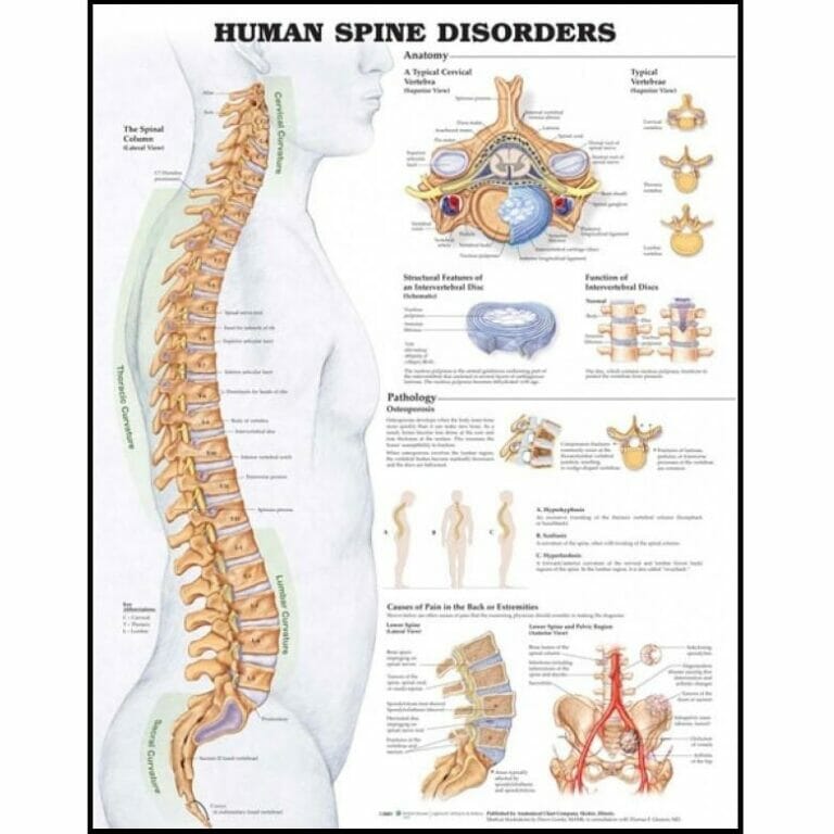 Human Spine Disorders Anatomical Chart - Chiro1source